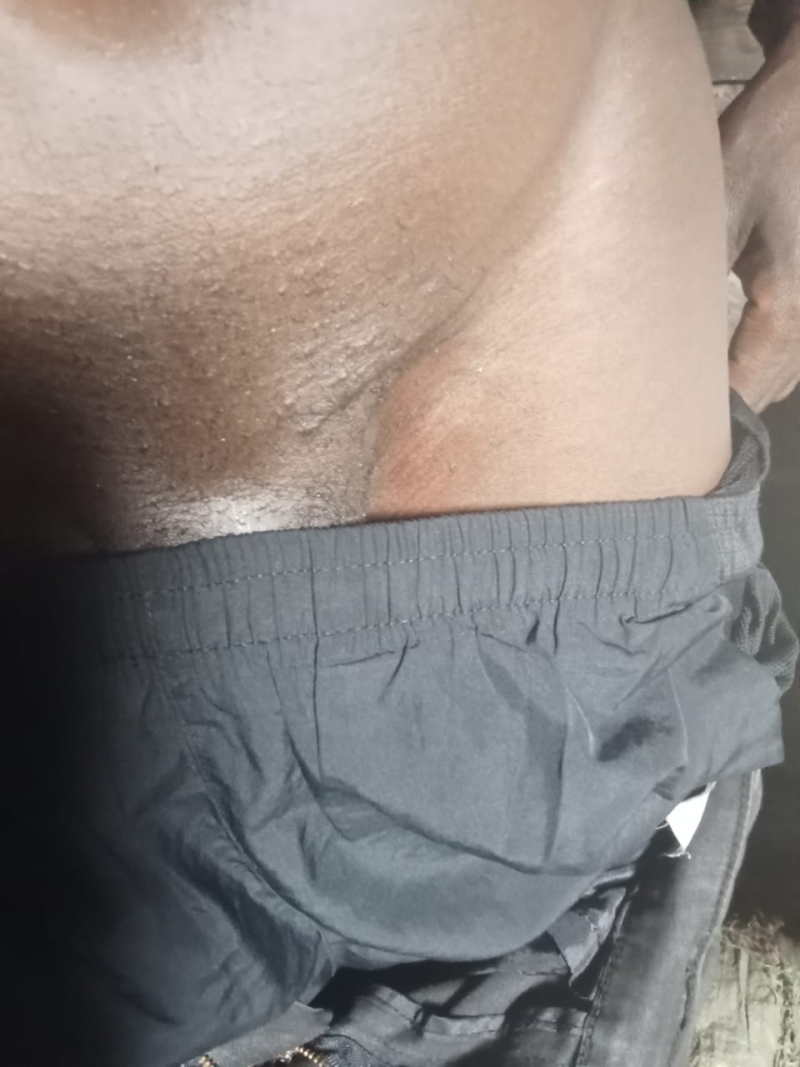 Patient Accuses Testimony Medical Centre in Iganga of Removing His Testicle